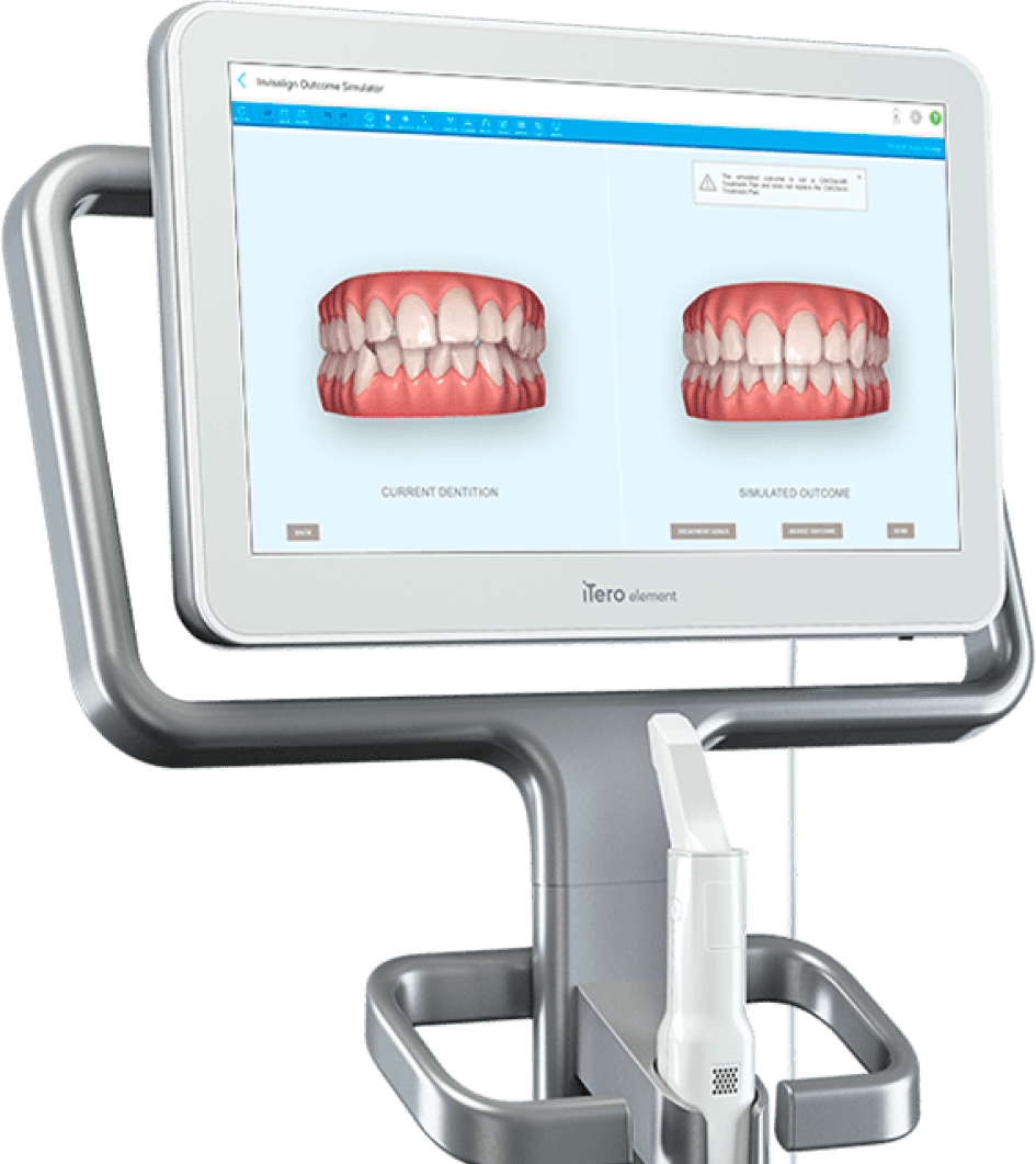 Teeth Scanning machine