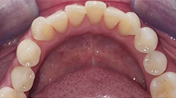 Ortho Case 1 A
