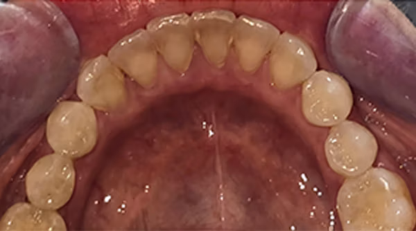 Ortho Case 1 B