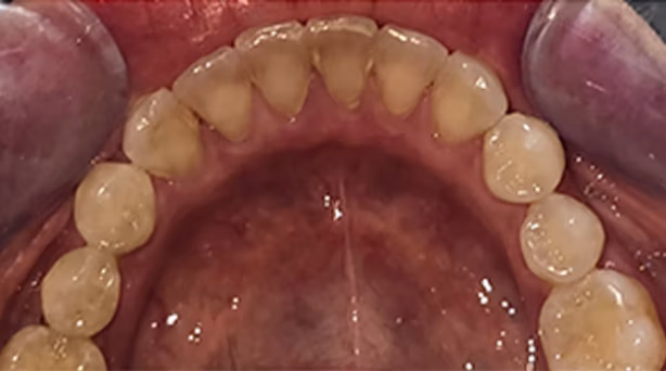 Ortho Case 1 B