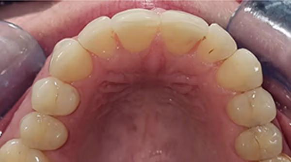 Ortho Case 10 A