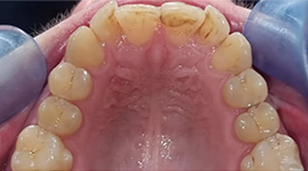 Ortho Case 10 B