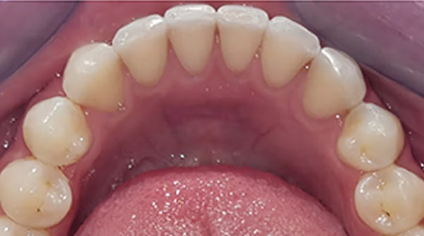 Ortho Case 11 A