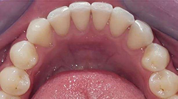 Ortho Case 11 A