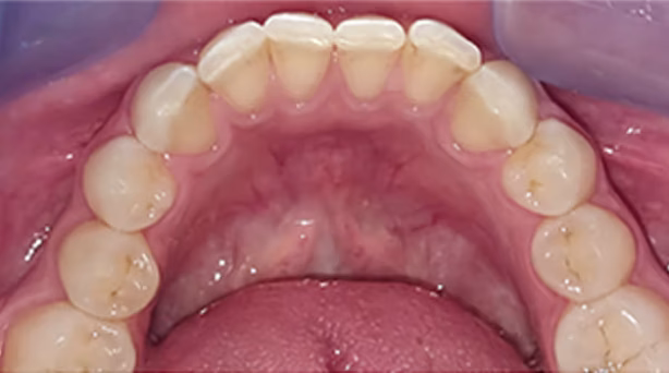 Ortho Case 11 B