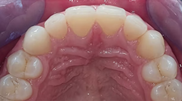 Ortho Case 12 A