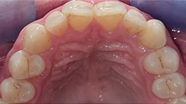 Ortho Case 12 B
