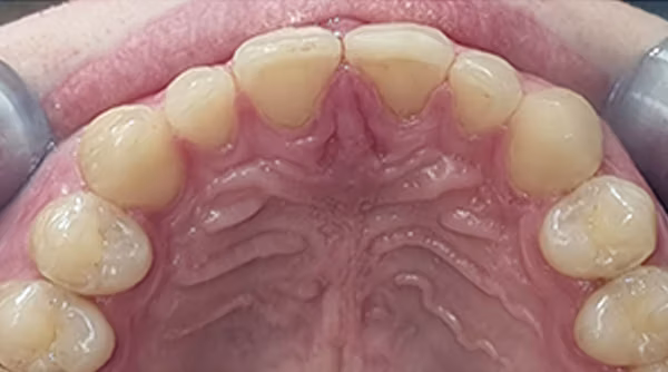 Ortho Case 13 A