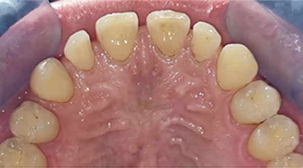 Ortho Case 13 B