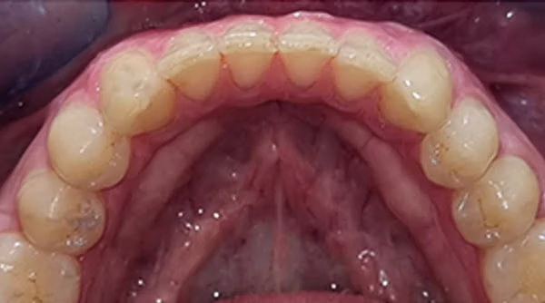 Ortho Case 14 A