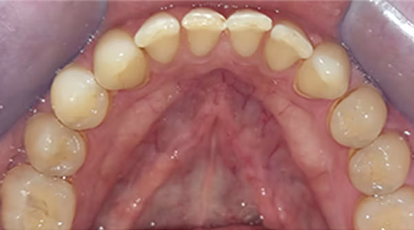 Ortho Case 14 B