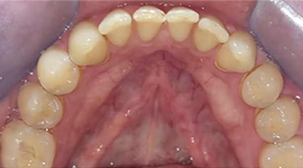 Ortho Case 14 B