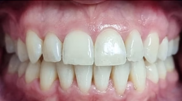 Ortho Case 15 A