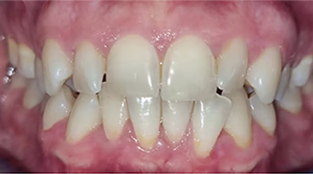 Ortho Case 15 B