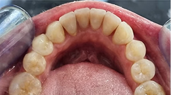 Ortho Case 16 A