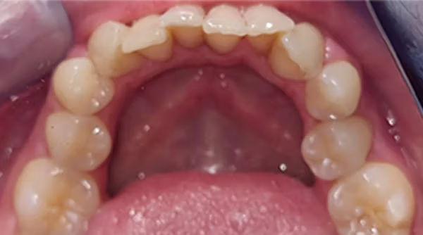 Ortho Case 16 B