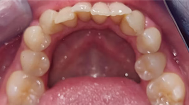 Ortho Case 16 B