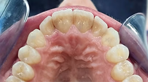 Ortho Case 17 A