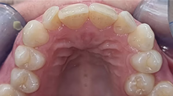 Ortho Case 17 B