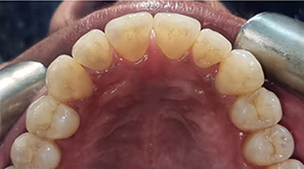 Ortho Case 18 A