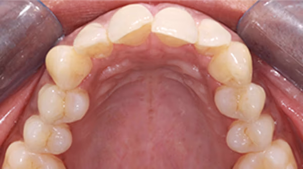 Ortho Case 18 B