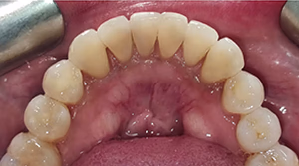 Ortho Case 19 A