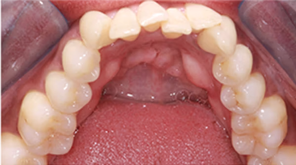 Ortho Case 19 B