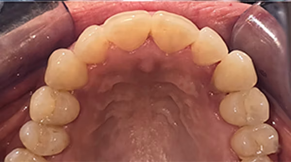 Ortho Case 2 A