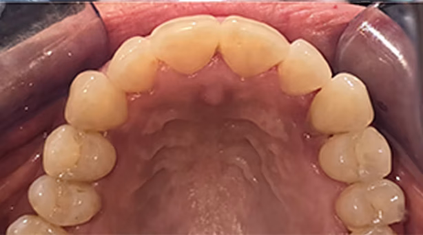 Ortho Case 2 A