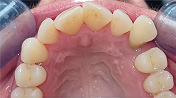 Ortho Case 2 B