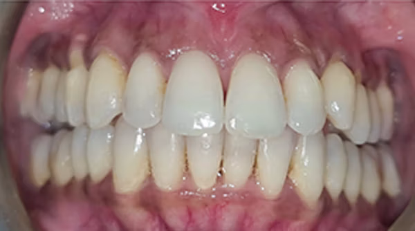 Ortho Case 20 A
