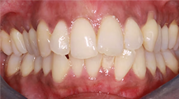 Ortho Case 20 B