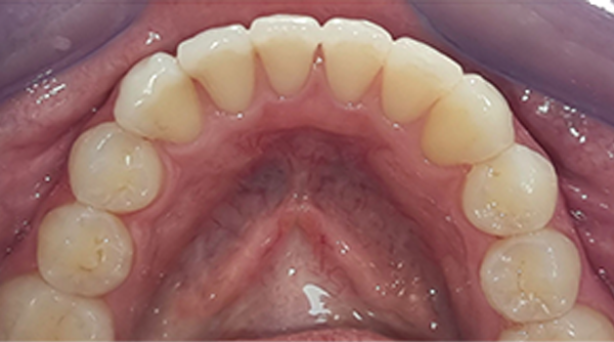 Ortho Case 21 A