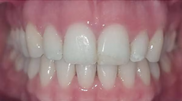 Ortho-Case-21-A
