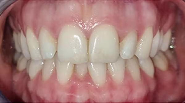 Ortho-Case-21-B