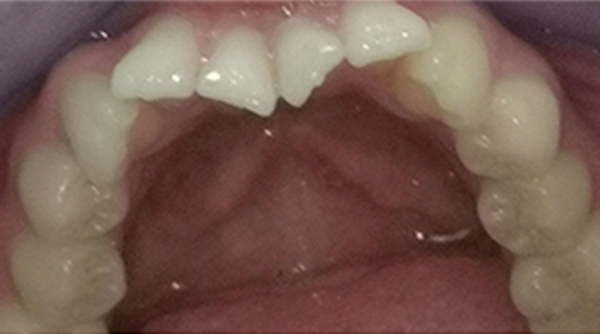 Ortho Case 21 B