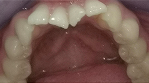 Ortho Case 21 B