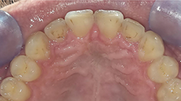Ortho Case 22 A