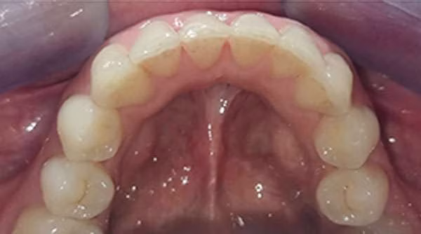 Ortho-Case-22-A