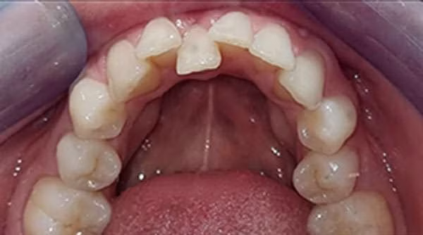 Ortho-Case-22-B