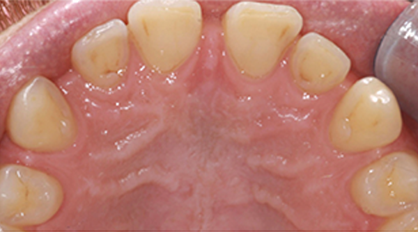 Ortho Case 22 B