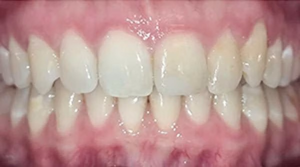 Ortho-Case-23-A