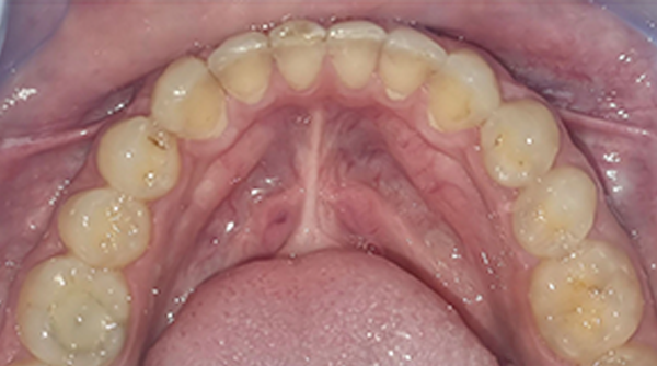Ortho Case 23 A