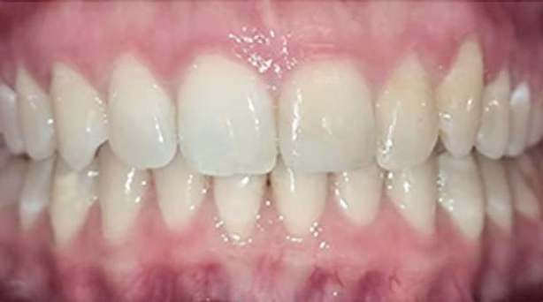 Ortho-Case-23-A