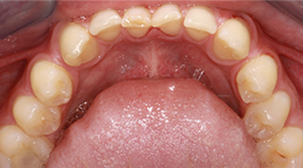 Ortho Case 23 B