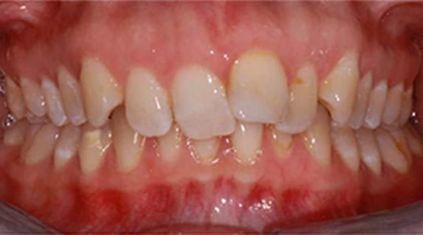 Ortho-Case-23-B