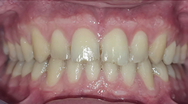 Ortho Case 24 A