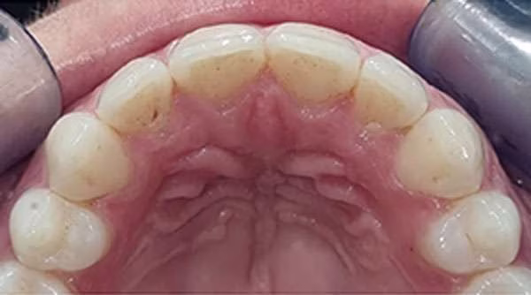 Ortho-Case-24-A