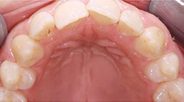 Ortho-Case-24-B