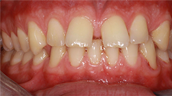 Ortho Case 24 B